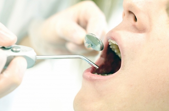 歯の定期検診の画像